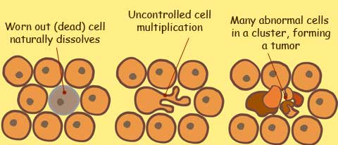 abnormal cells multiply to form tumor