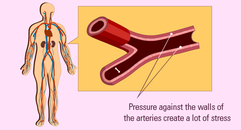 hypertension for children