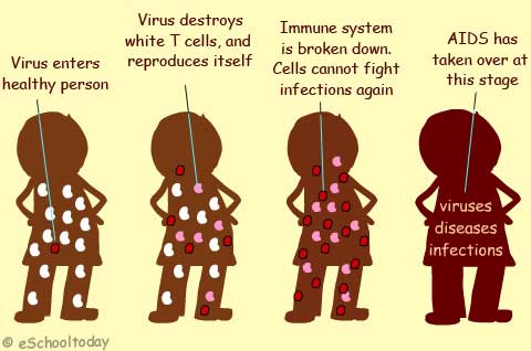 how HIV aids is caused