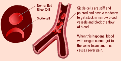abnormal blood cell