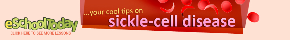 Sickle cell information for children