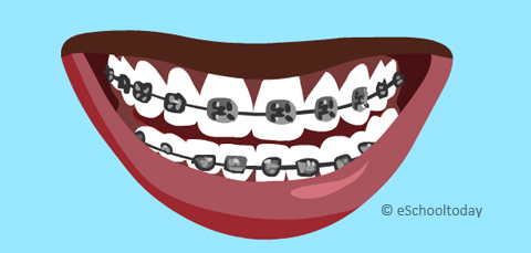 eschooltoday dientes