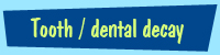 Tooth, gum or dental decay